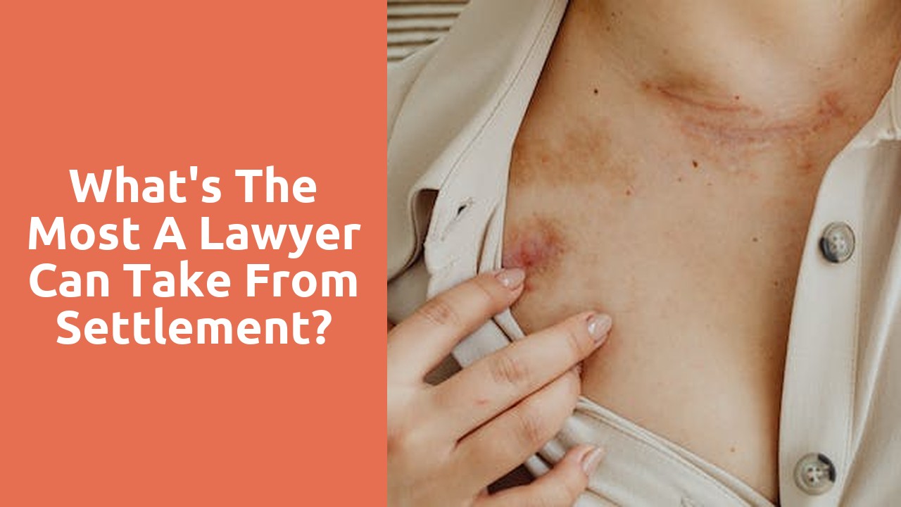 What's the most a lawyer can take from settlement?